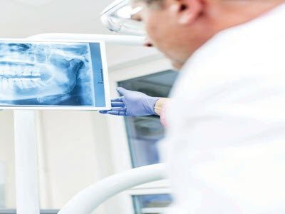 dentoscope